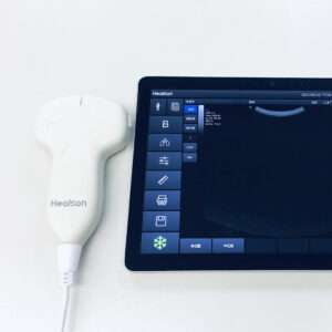 Convex Portable Ultrasound Probe