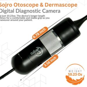 Oto-Dermascope: Advanced Digital Otoscope & Dermascope for Medical Professionals with image capturing and video recording